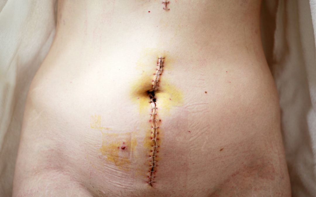 Trpljenje kot prepovedano čustvo